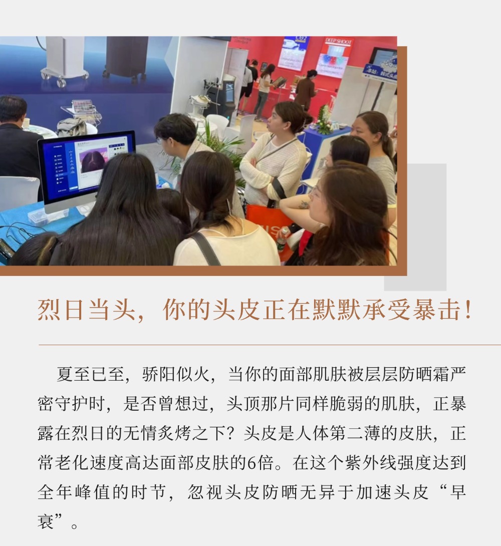 夏至高温警报！头皮晒伤三大症状，你中招吗？