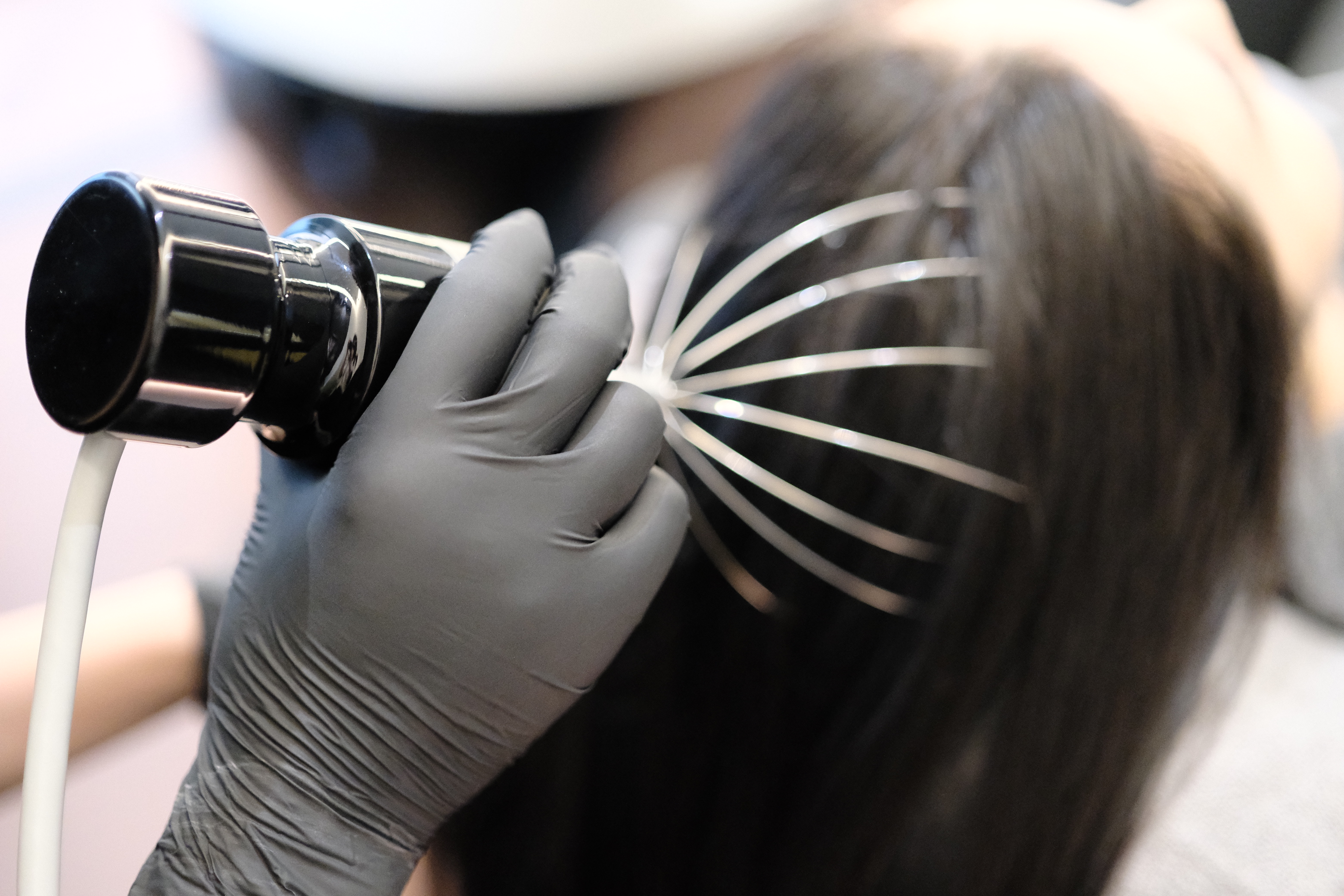 医生提醒:显年轻的人,头皮都有这些特征